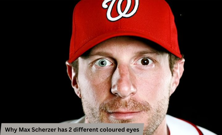 Why Max Scherzer has 2 different coloured eyes